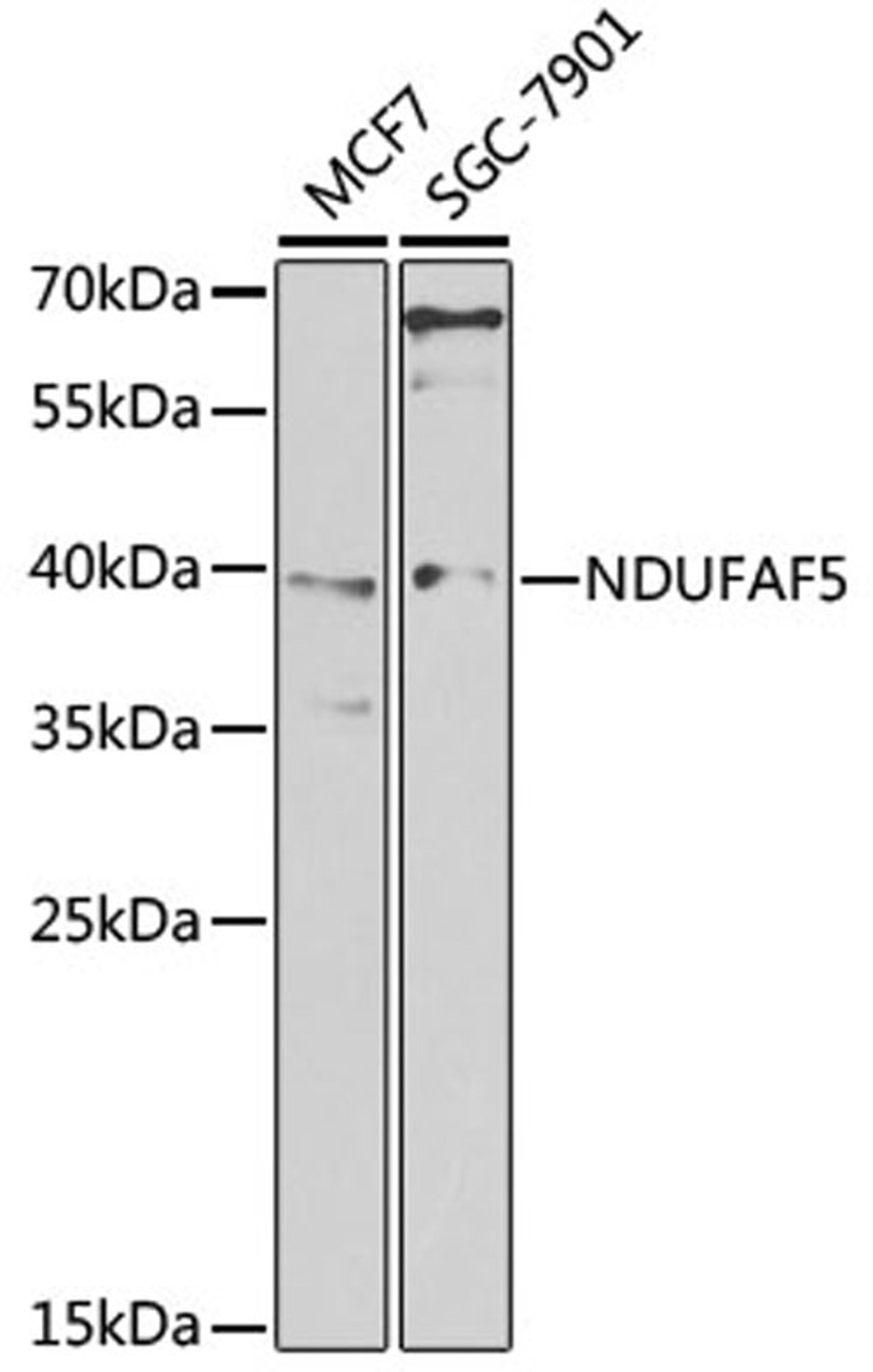 Western blot - NDUFAF5 antibody (A7135)