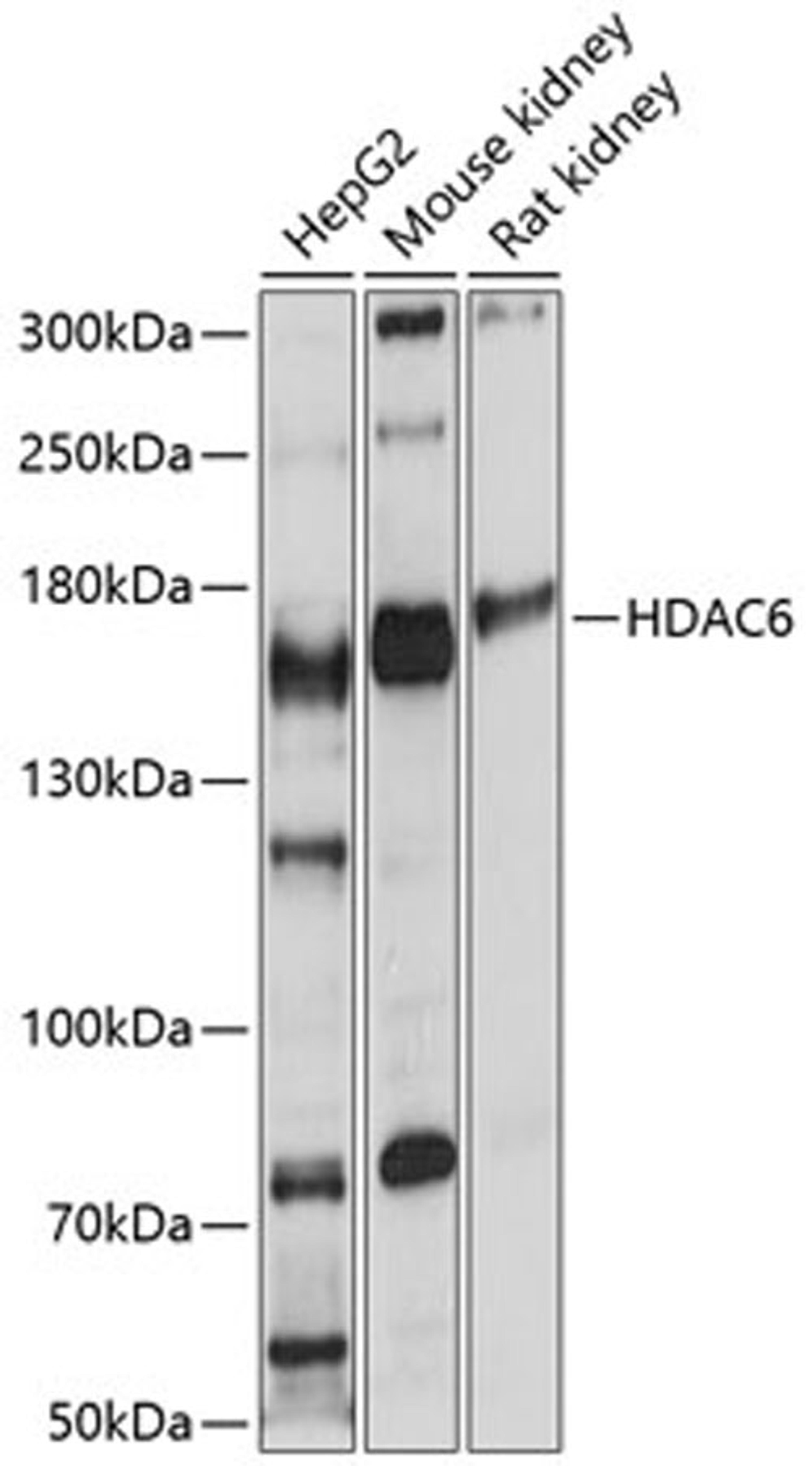 Western blot - HDAC6 antibody (A11261)