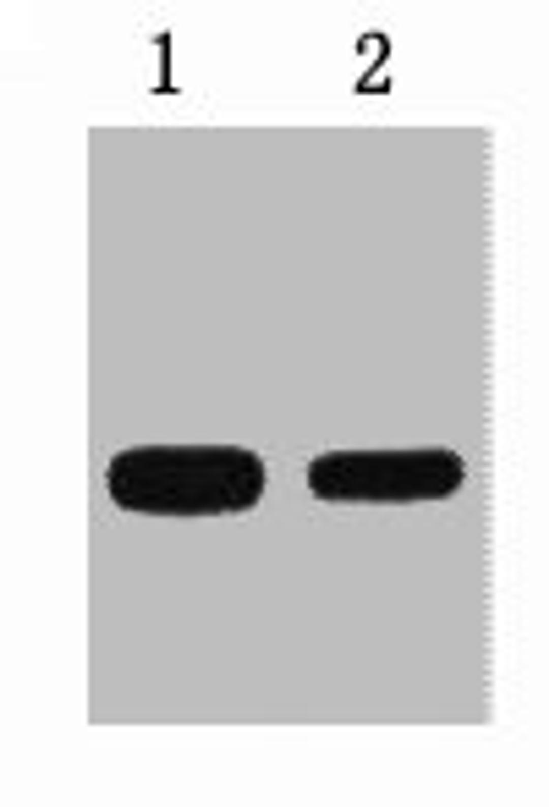 2ug GFP fusion protein+ Primary antibody dilution at  1) 1:5000 2) 1:10000