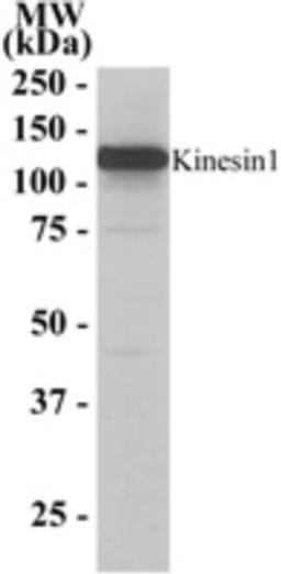 Western Blot: Kinesin 5B Antibody [NB100-1059] - Analysis of Kinesin 5B in human kidney lysate (RIPA buffer, 35 ug total protein per lane) using this antibody (0.2 ug/ml). Primary incubation was 1 hour. Detected by chemiluminescence.