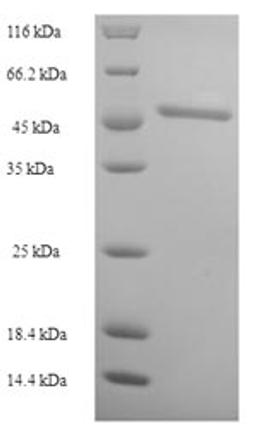 (Tris-Glycine gel) Discontinuous SDS-PAGE (reduced) with 5% enrichment gel and 15% separation gel.