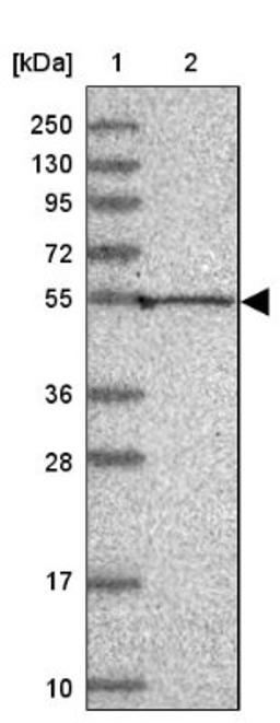 Western Blot: Pan KvBeta Antibody [NBP1-90194] - Lane 1: Marker [kDa] 250, 130, 95, 72, 55, 36, 28, 17, 10<br/>Lane 2: Human cell line RT-4