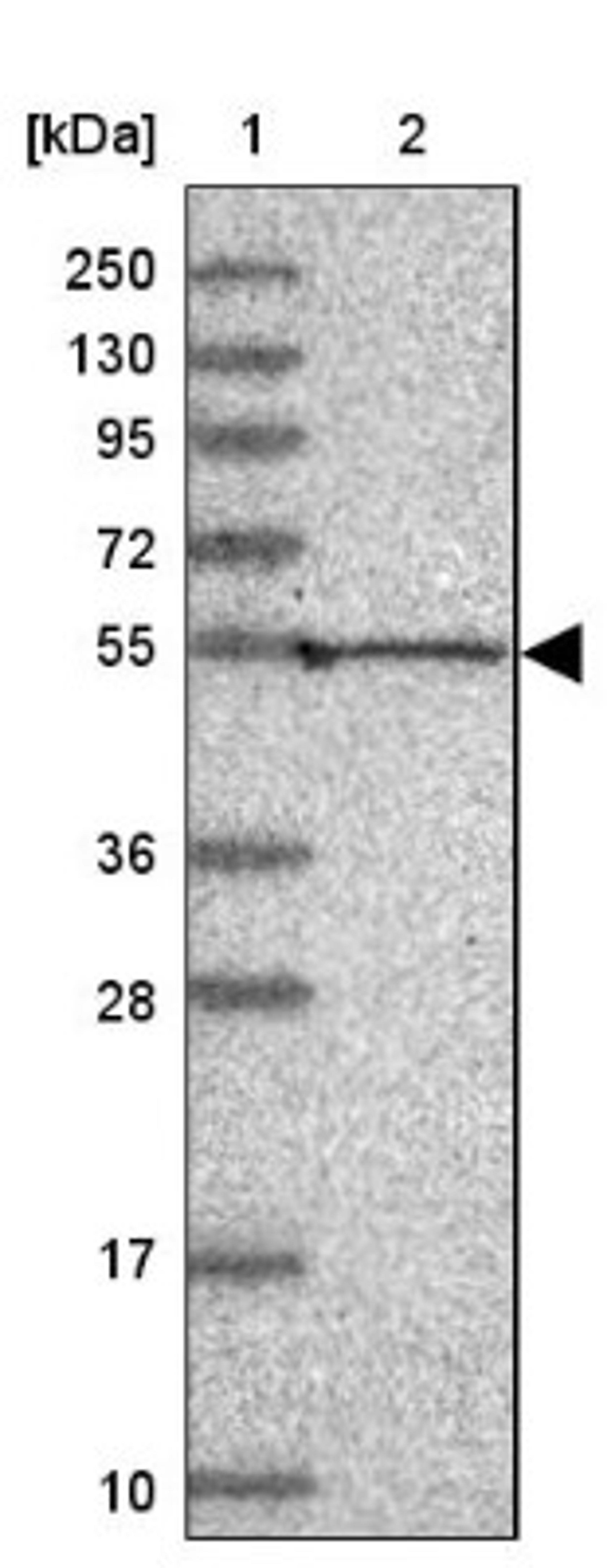 Western Blot: Pan KvBeta Antibody [NBP1-90194] - Lane 1: Marker [kDa] 250, 130, 95, 72, 55, 36, 28, 17, 10<br/>Lane 2: Human cell line RT-4