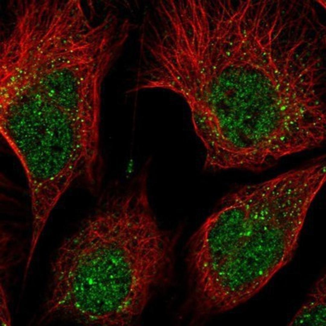 Immunocytochemistry/Immunofluorescence: Dyrk1B Antibody [NBP1-82643] - Staining of human cell line U-2 OS shows positivity in nucleus but not nucleoli & vesicles.