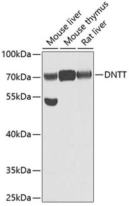 Western blot - DNTT antibody (A6254)