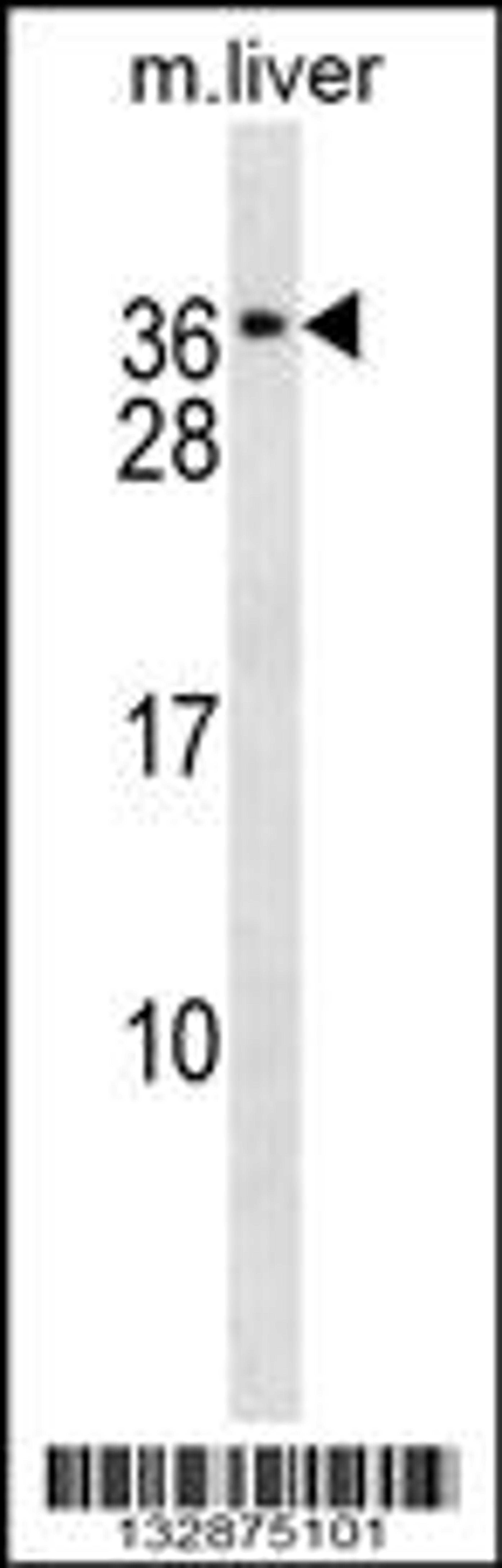 Western blot analysis in mouse liver tissue lysates (35ug/lane).