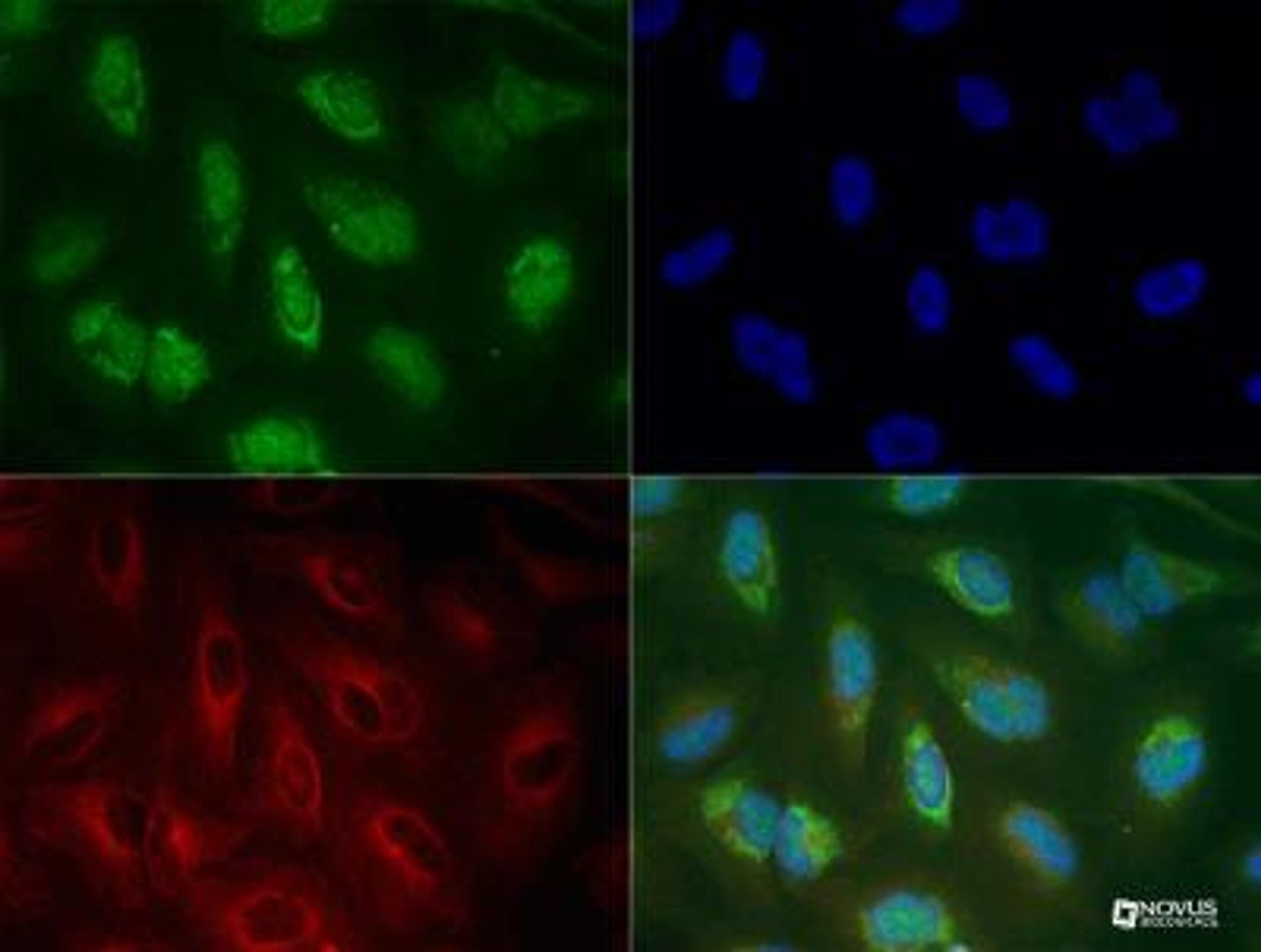 PINK1 Antibody [BC100-494] - Immunocytochemistry of PINK1 antibody (BC100-494 Lot G).  HeLa cells were treated with valinomycin (1 uM for 24h) prior to being fixed in 10% buffered formalin for 10 min and permeabilized in 0.1% Triton X-100 in PBS for 10 min.  Cells were incubated with BC100-494 at 20 ug/ml for 1h at room temperature, washed 3x in PBS and incubated with Alexa-Fluor488 anti-rabbit secondary antibody.  PINK1 (Green) was detected at the mitochondria.  Tubulin (Red) was detected using an anti-tubulin antibody with an anti-mouse DyLight 550 secondary antibody.  DNA (Blue) was counterstained with DAPI.  Note: mitochondria staining might not be easily observed without treatment with valinomycin or CCCP.