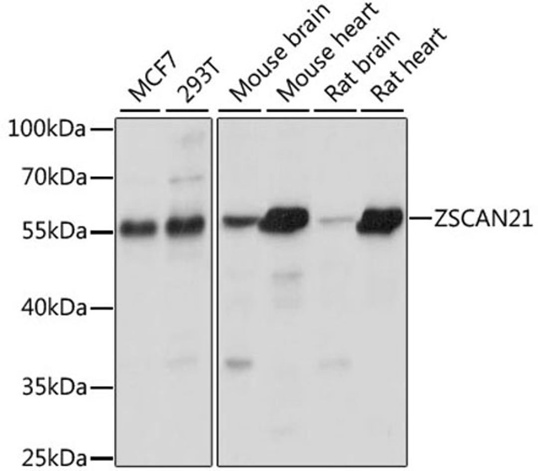 Western blot - ZSCAN21 antibody (A15330)