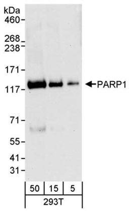 Detection of human PARP1 by western blot.