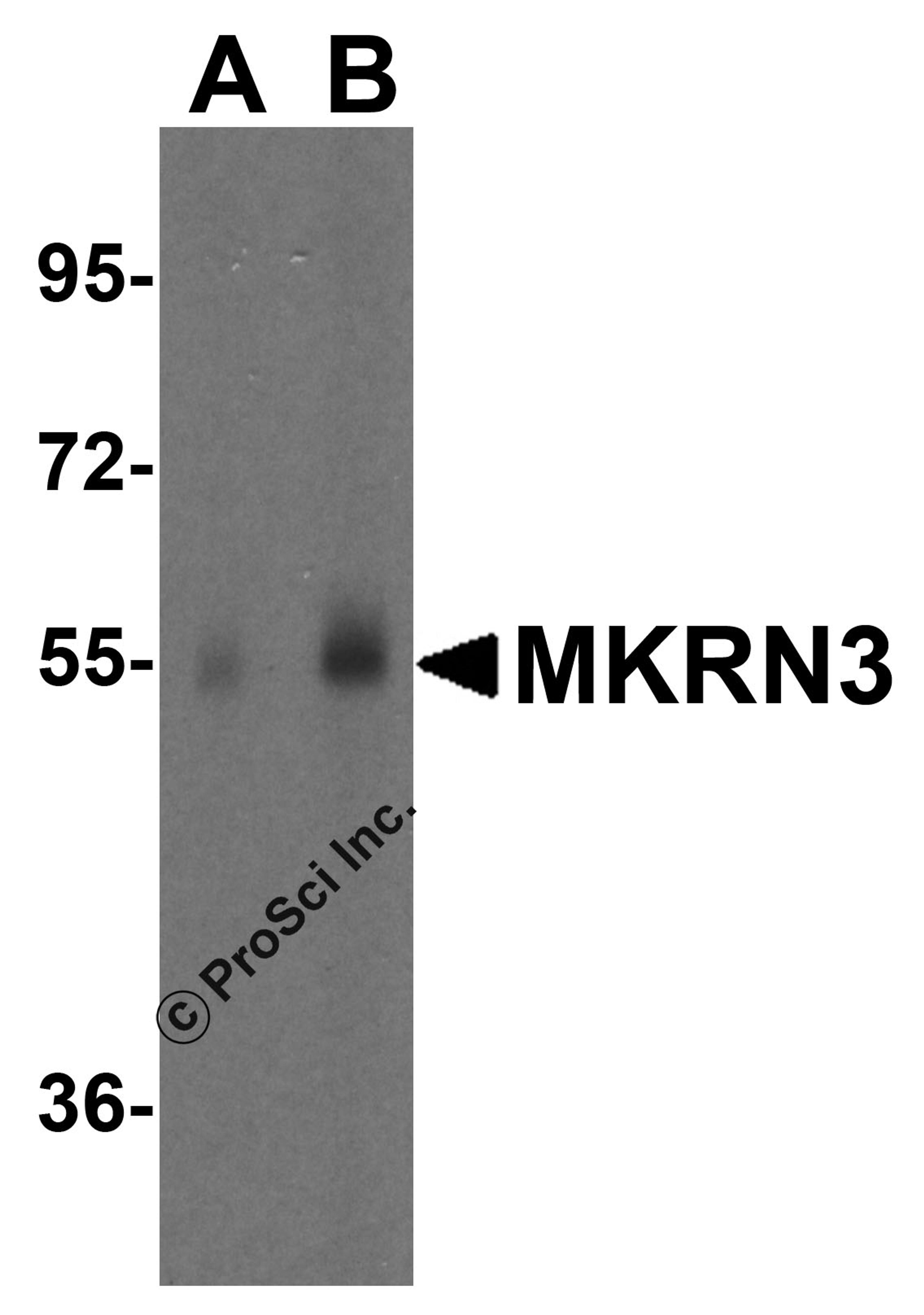 Western blot analysis of MKRN3 in human spleen tissue lysate with MKRN3 antibody at (A)1 and (B) 2 μg/ml.