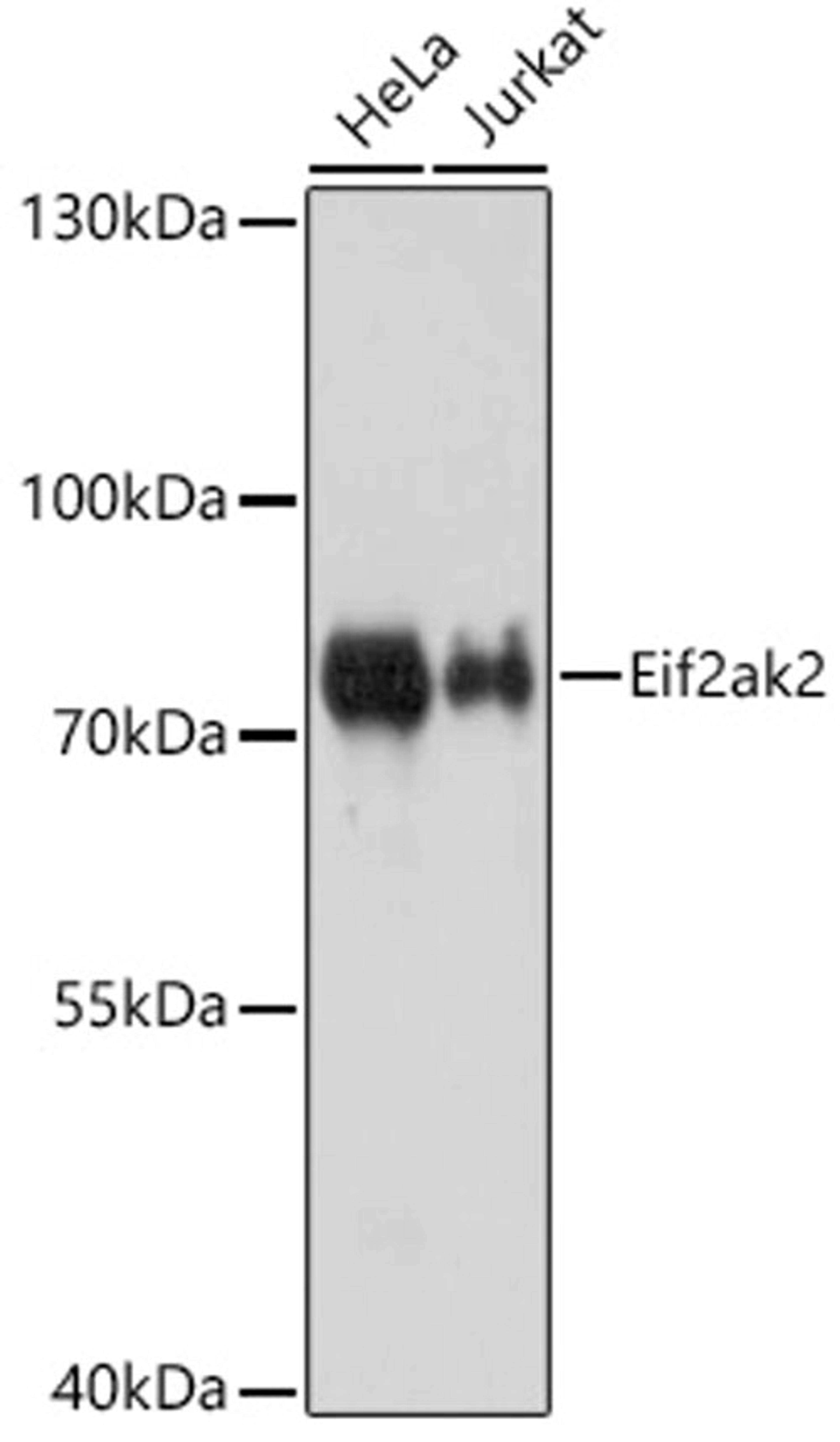 Western blot - Eif2ak2 antibody (A5578)