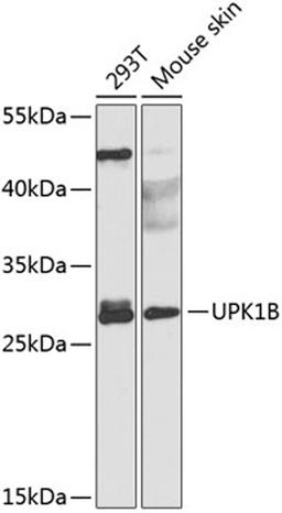 Western blot - UPK1B antibody (A8157)