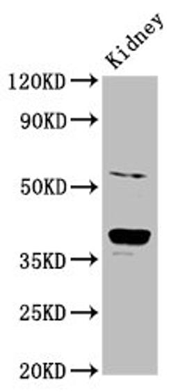 Western Blot. Positive WB detected in: Rat kidney tissue. All lanes: CD300LG antibody at 6ug/ml. Secondary. Goat polyclonal to rabbit IgG at 1/50000 dilution. Predicted band size: 37, 27, 25, 34, 30 kDa. Observed band size: 37 kDa. 