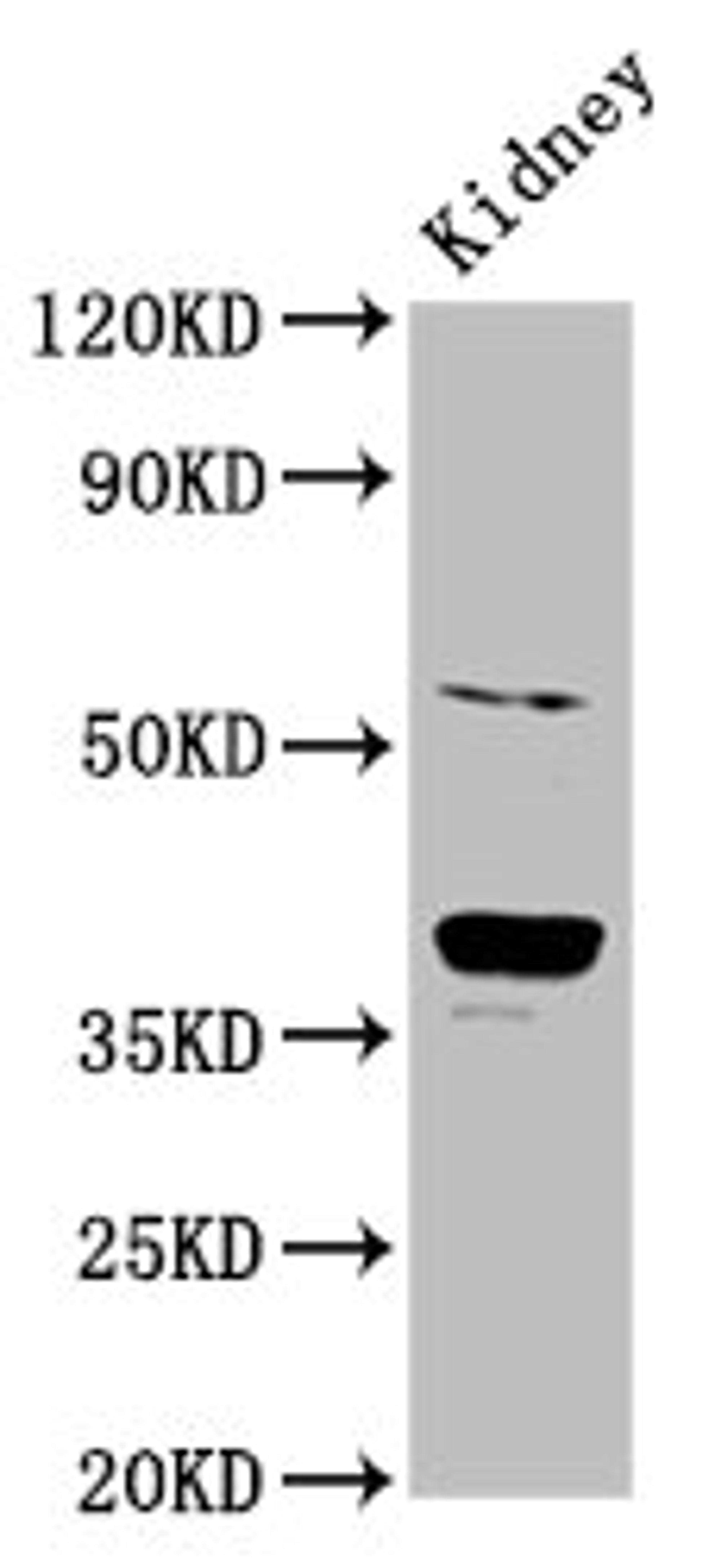 Western Blot. Positive WB detected in: Rat kidney tissue. All lanes: CD300LG antibody at 6ug/ml. Secondary. Goat polyclonal to rabbit IgG at 1/50000 dilution. Predicted band size: 37, 27, 25, 34, 30 kDa. Observed band size: 37 kDa. 