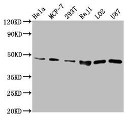 Western Blot. Positive WB detected in: Hela whole cell lysate, MCF-7 whole cell lysate, 293T whole cell lysate, Raji whole cell lysate, LO2 whole cell lysate, U87 whole cell lysate, . All lanes: SUCLG2 antibody at 6.7µg/ml. Secondary. Goat polyclonal to rabbit IgG at 1/50000 dilution. Predicted band size: 47, 48 kDa. Observed band size: 47 kDa