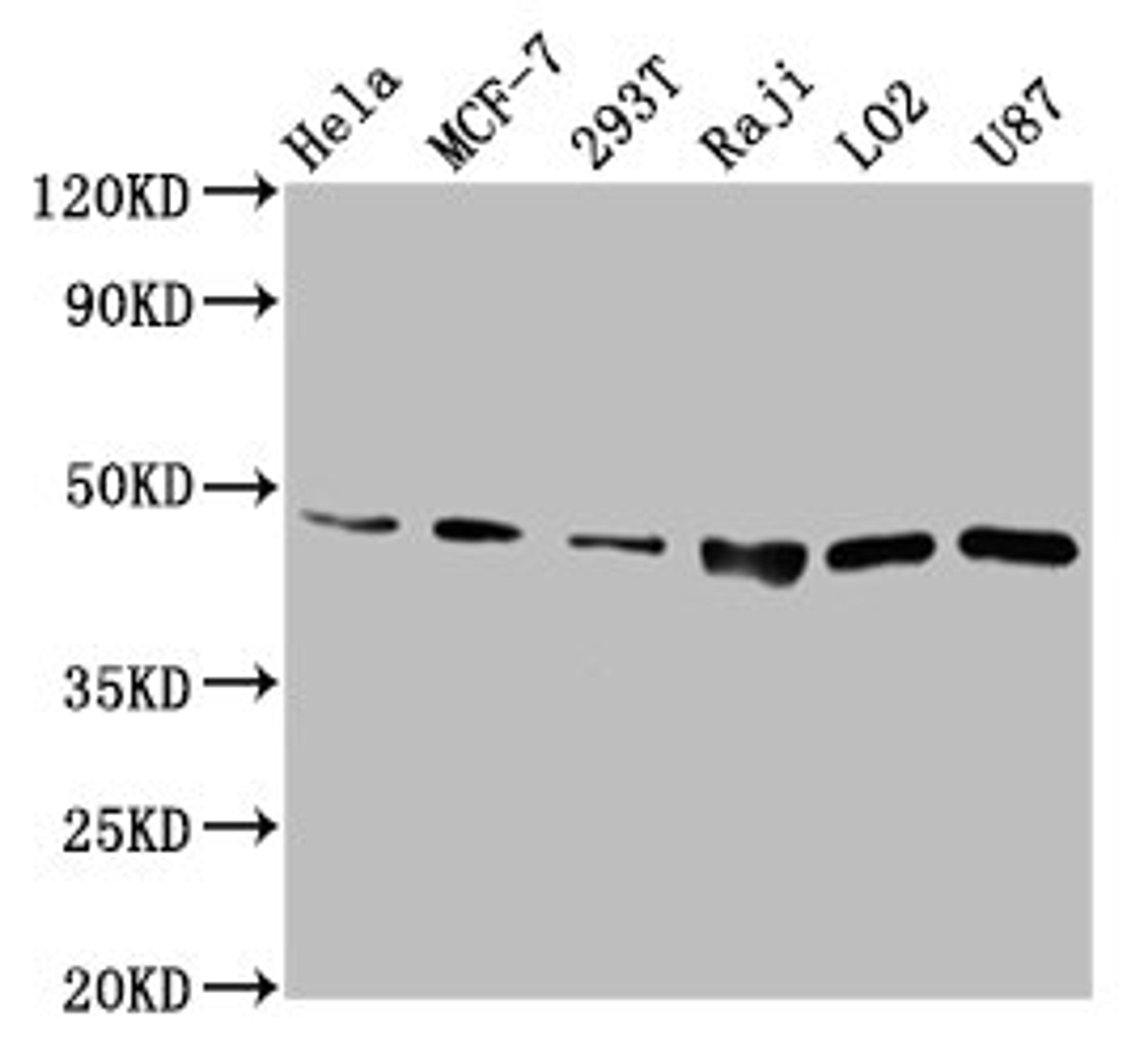 Western Blot. Positive WB detected in: Hela whole cell lysate, MCF-7 whole cell lysate, 293T whole cell lysate, Raji whole cell lysate, LO2 whole cell lysate, U87 whole cell lysate, . All lanes: SUCLG2 antibody at 6.7µg/ml. Secondary. Goat polyclonal to rabbit IgG at 1/50000 dilution. Predicted band size: 47, 48 kDa. Observed band size: 47 kDa
