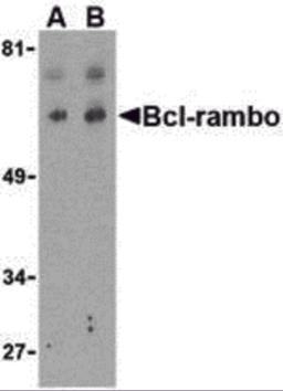 Western blot analysis of Bcl-rambo in K562 cell lysate with Bcl-rambo antibody at (A) 2 and (B) 4 &#956;g/mL. 