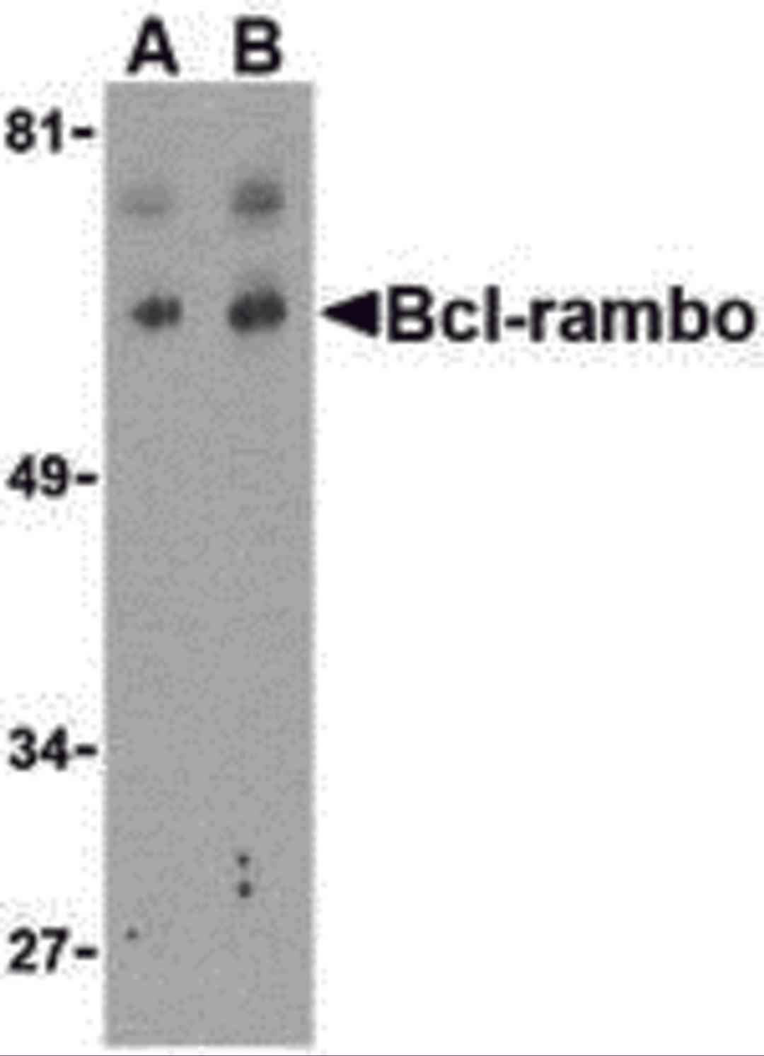 Western blot analysis of Bcl-rambo in K562 cell lysate with Bcl-rambo antibody at (A) 2 and (B) 4 μg/mL.