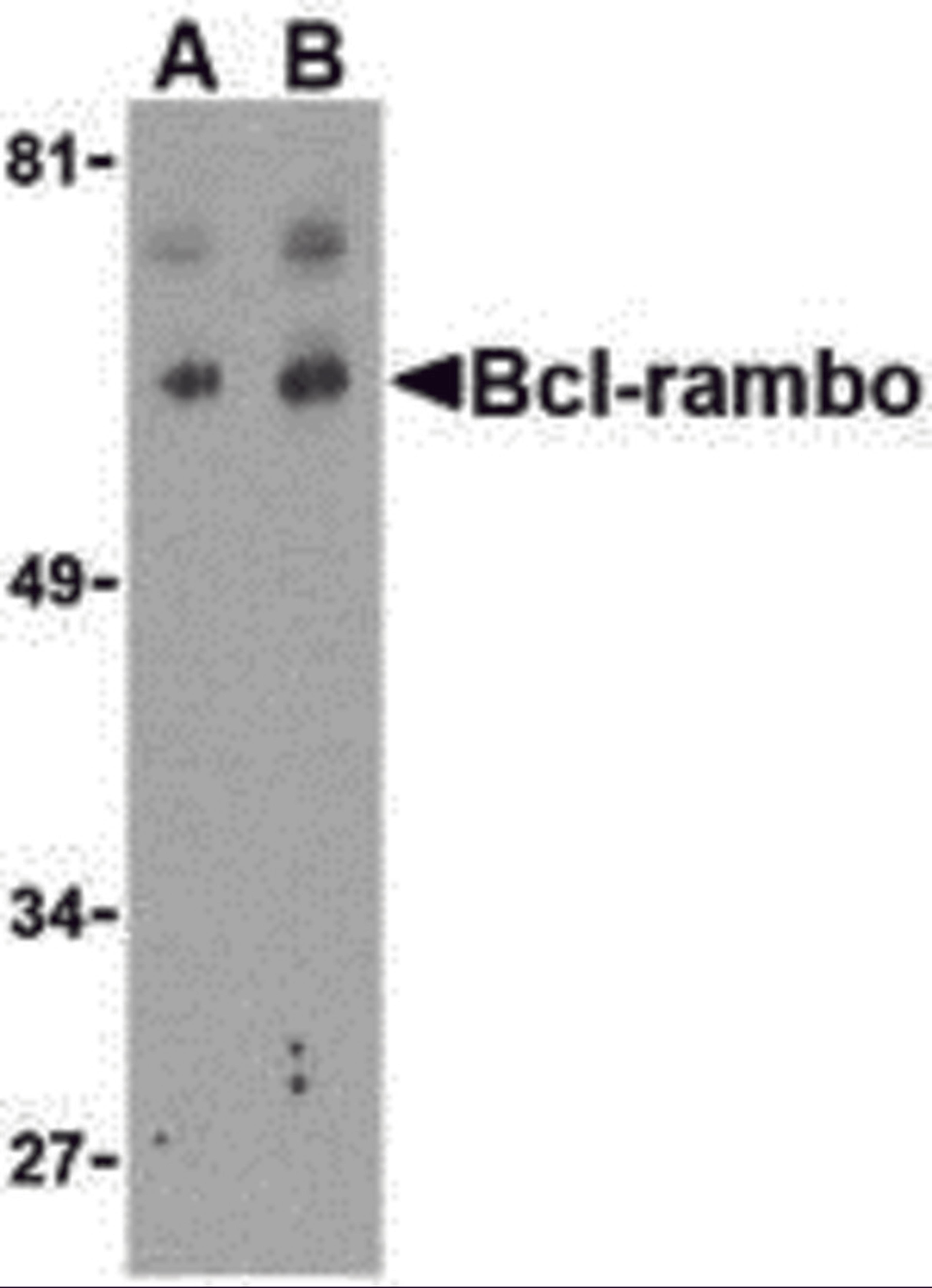 Western blot analysis of Bcl-rambo in K562 cell lysate with Bcl-rambo antibody at (A) 2 and (B) 4 μg/mL.