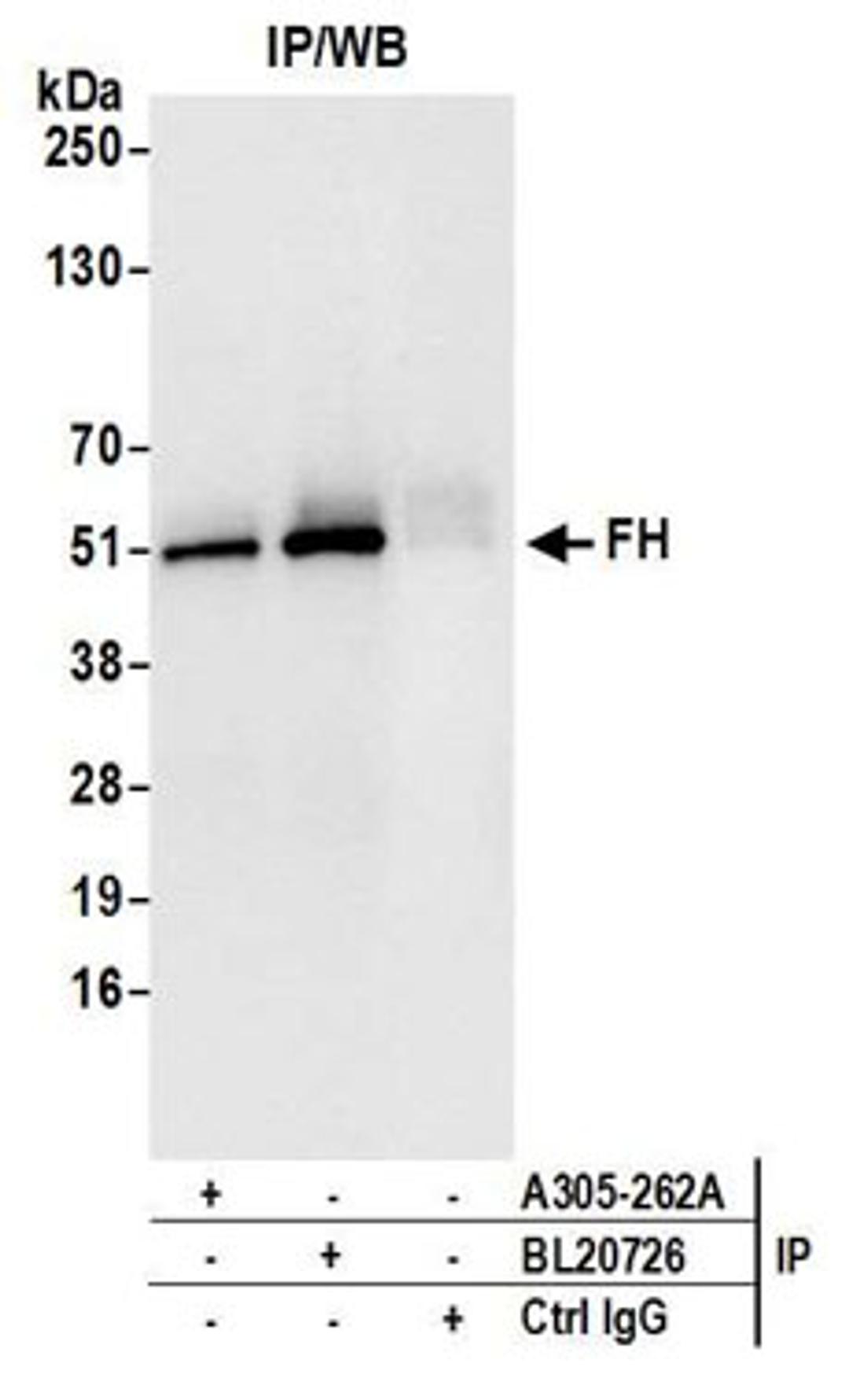 Detection of human FH by western blot of immunoprecipitates.