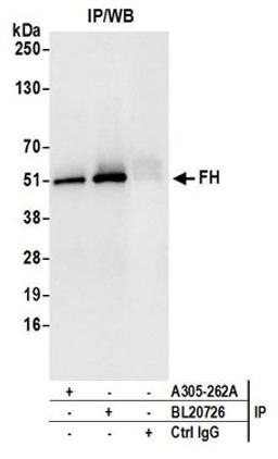 Detection of human FH by western blot of immunoprecipitates.