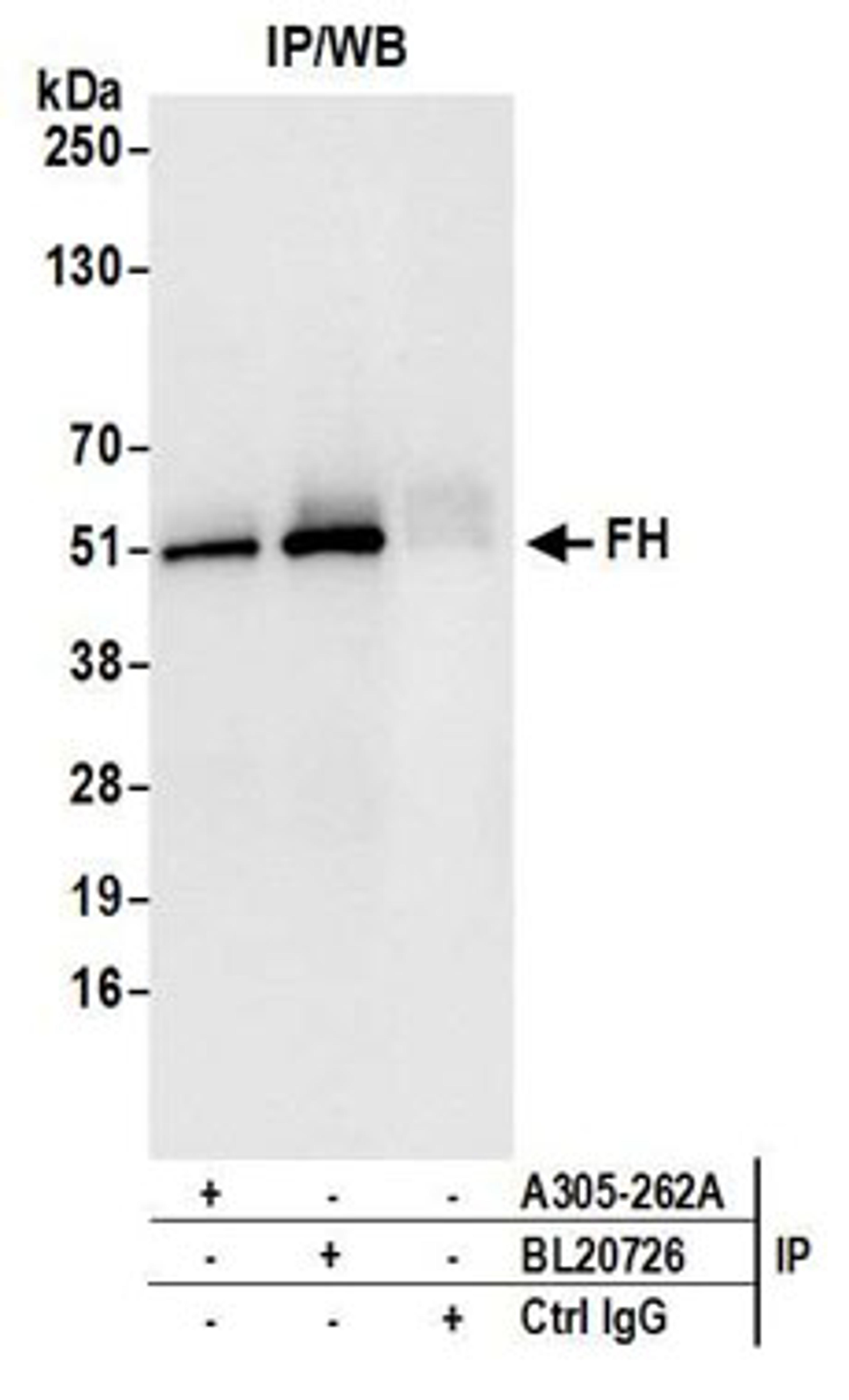 Detection of human FH by western blot of immunoprecipitates.