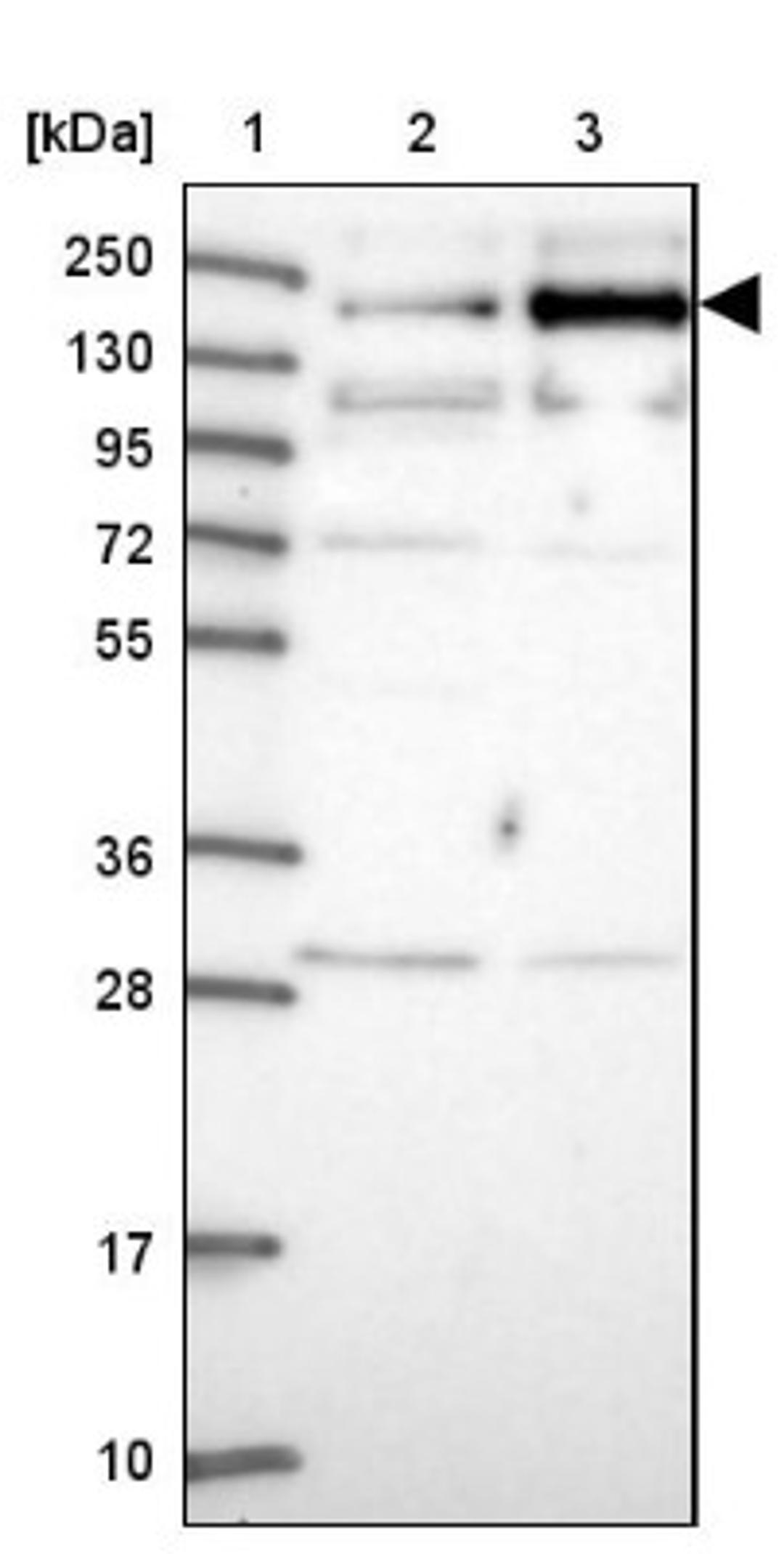 Western Blot: TMEM2 Antibody [NBP1-94168] - Lane 1: Marker [kDa] 250, 130, 95, 72, 55, 36, 28, 17, 10<br/>Lane 2: Human cell line RT-4<br/>Lane 3: Human cell line U-251MG sp