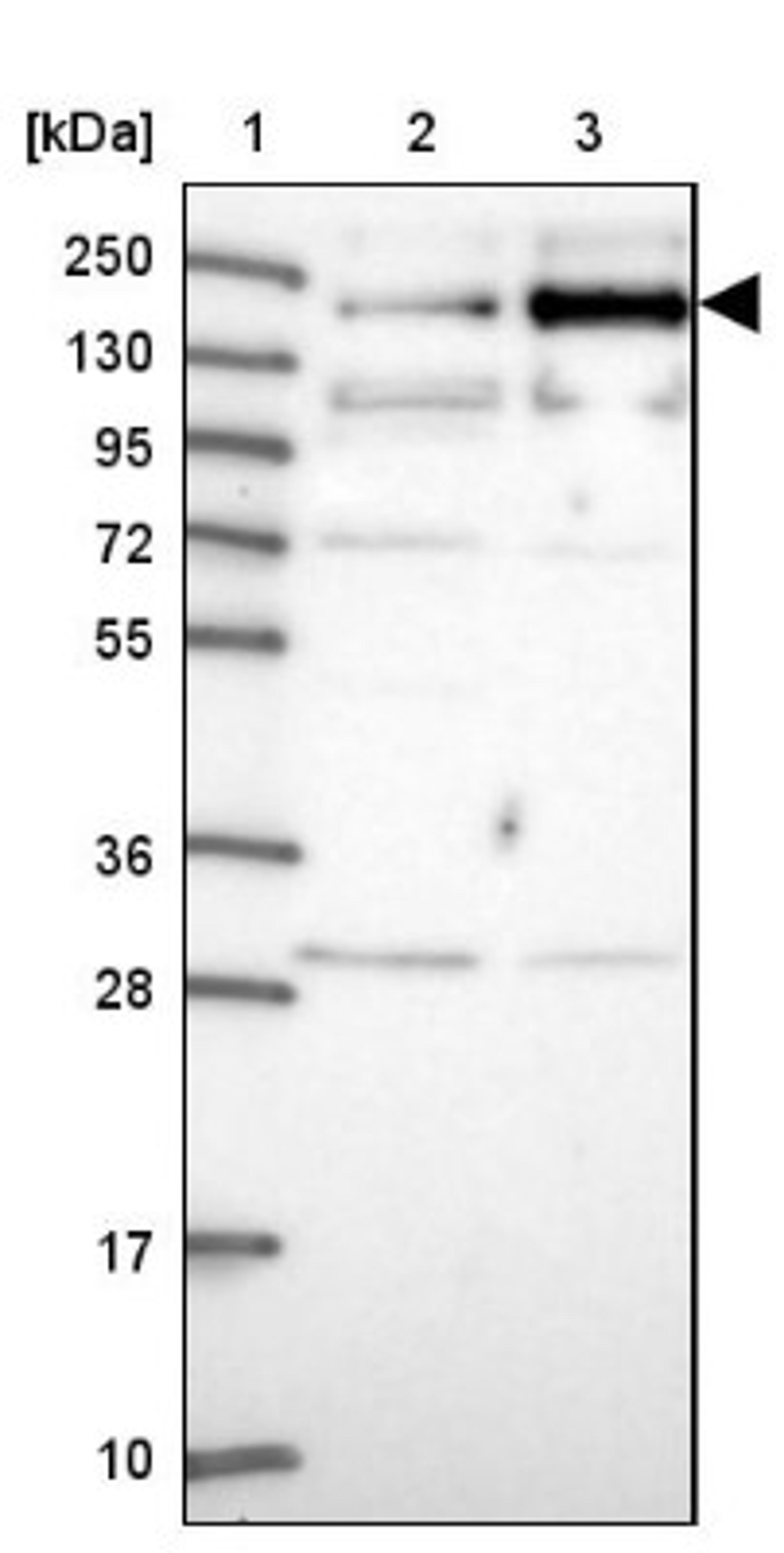 Western Blot: TMEM2 Antibody [NBP1-94168] - Lane 1: Marker [kDa] 250, 130, 95, 72, 55, 36, 28, 17, 10<br/>Lane 2: Human cell line RT-4<br/>Lane 3: Human cell line U-251MG sp