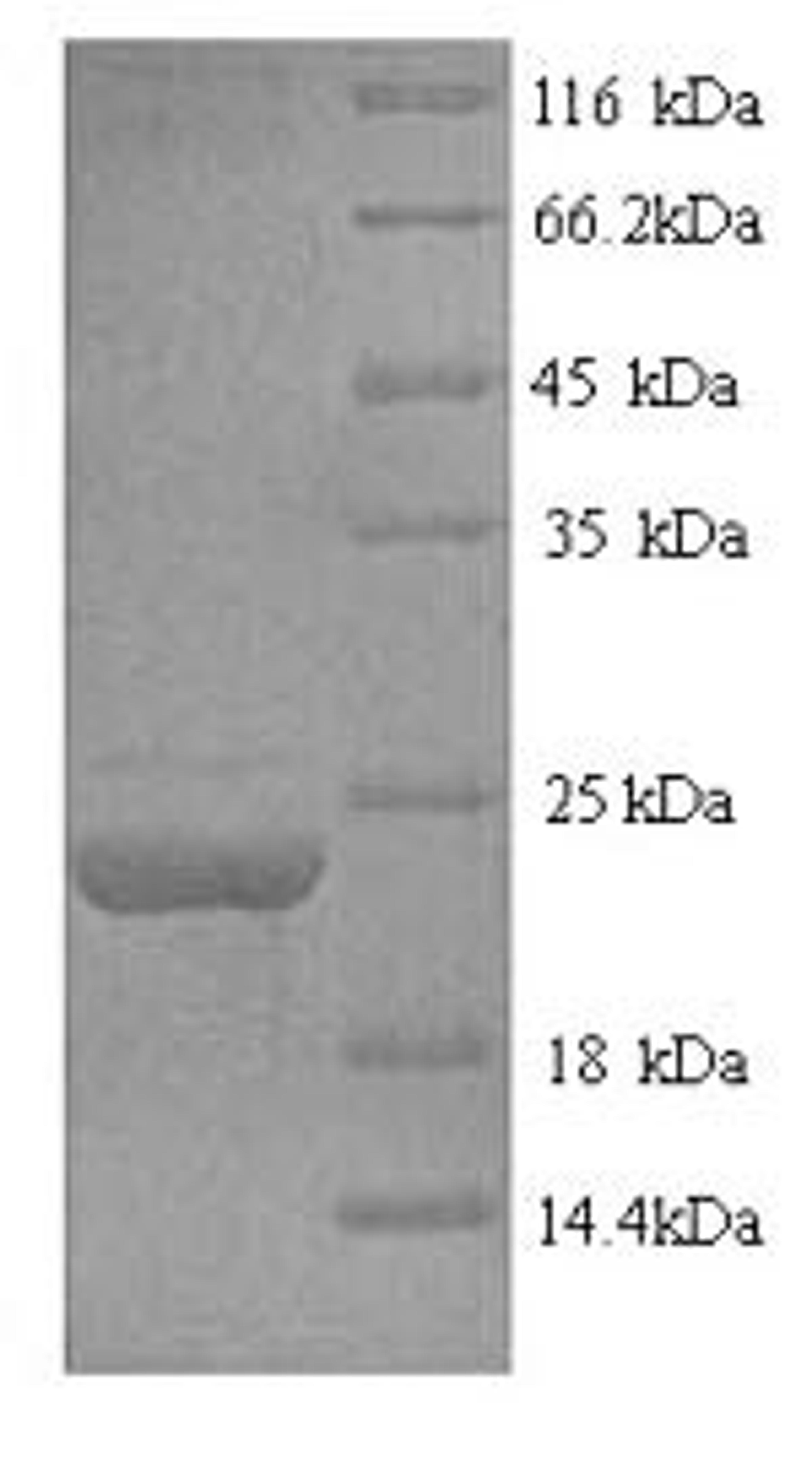 (Tris-Glycine gel) Discontinuous SDS-PAGE (reduced) with 5% enrichment gel and 15% separation gel.