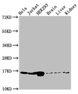 Western Blot. Positive WB detected in: Hela cell acid extracts, Jurkat cell acid extracts, HEK293 cell acid extracts, Mouse brain tissue, Mouse liver tissue, Mouse kidney tissue. All lanes: HIST1H3A antibody at 1µg/ml. Secondary. Goat polyclonal to rabbit IgG at 1/50000 dilution. Predicted band size: 16 kDa. Observed band size: 16 kDa
