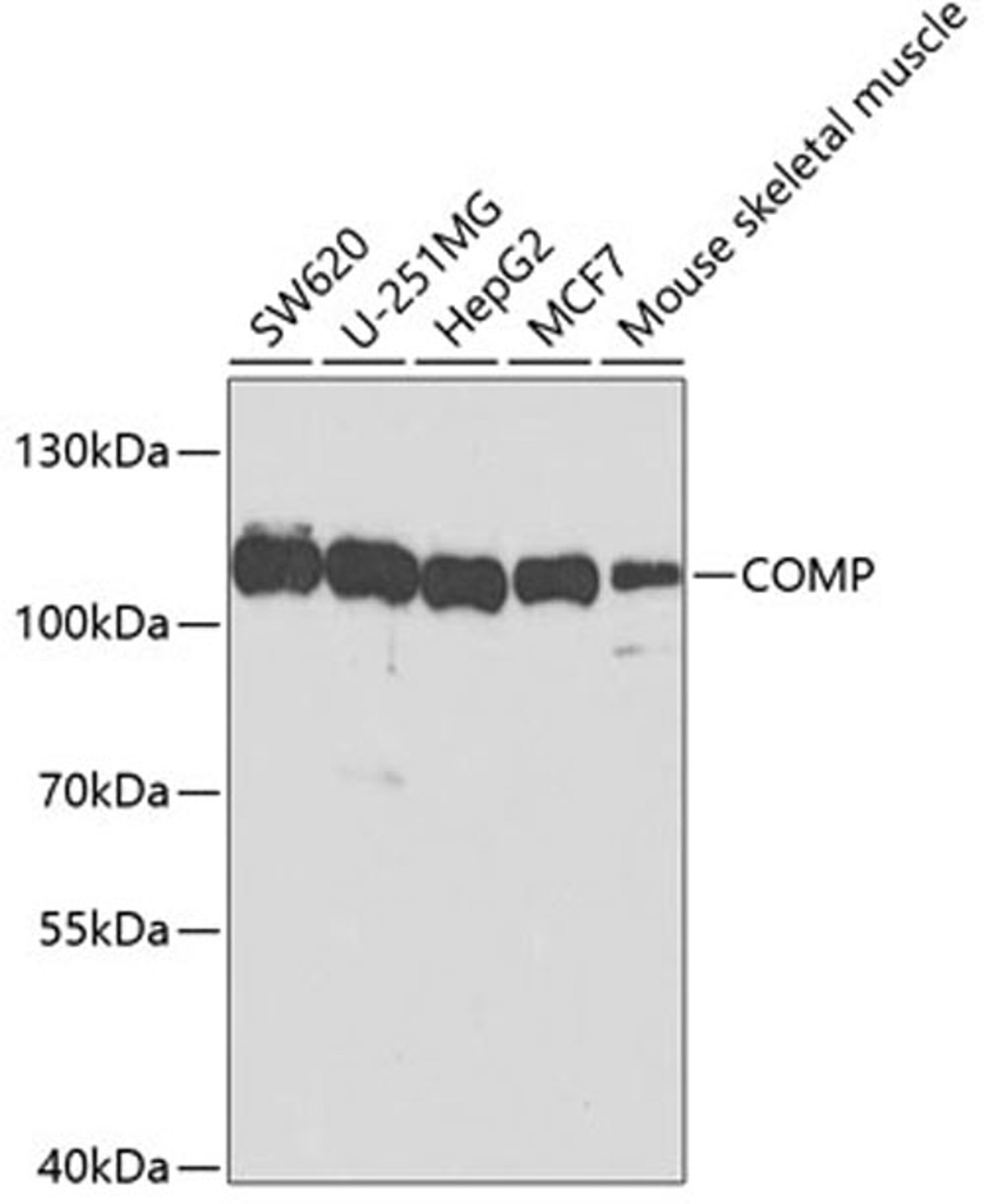 Western blot - COMP antibody (A5812)