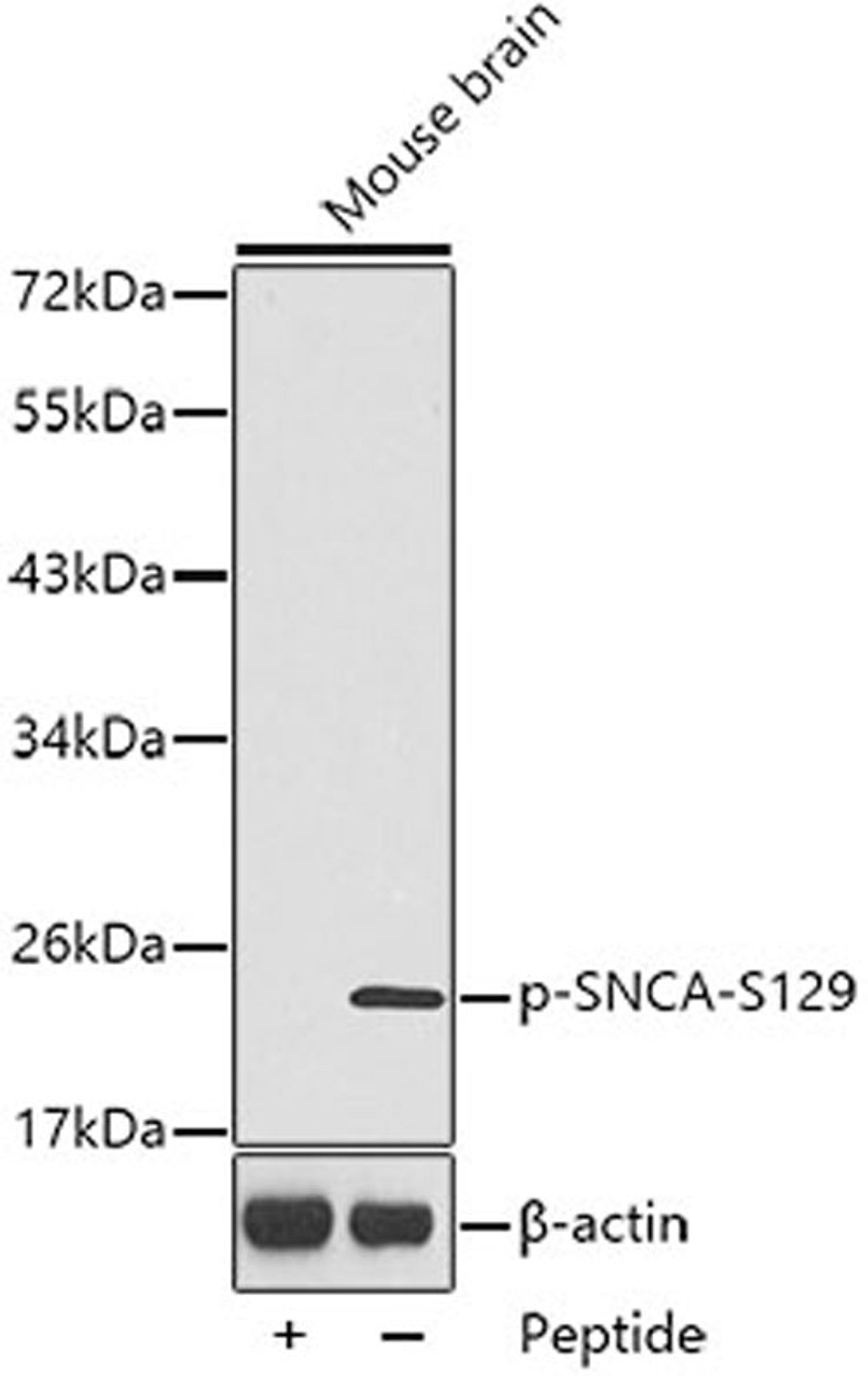 Western blot - Phospho-SNCA-S129 antibody (AP0450)