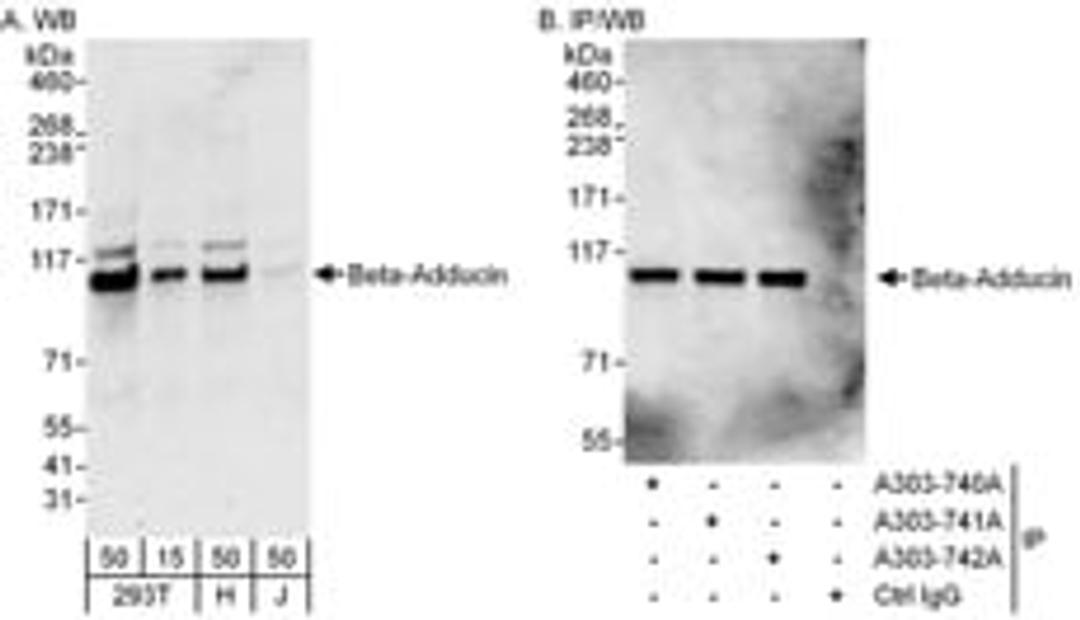 Detection of human Beta-Adducin by western blot and immunoprecipitation.