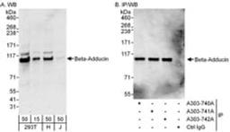 Detection of human Beta-Adducin by western blot and immunoprecipitation.