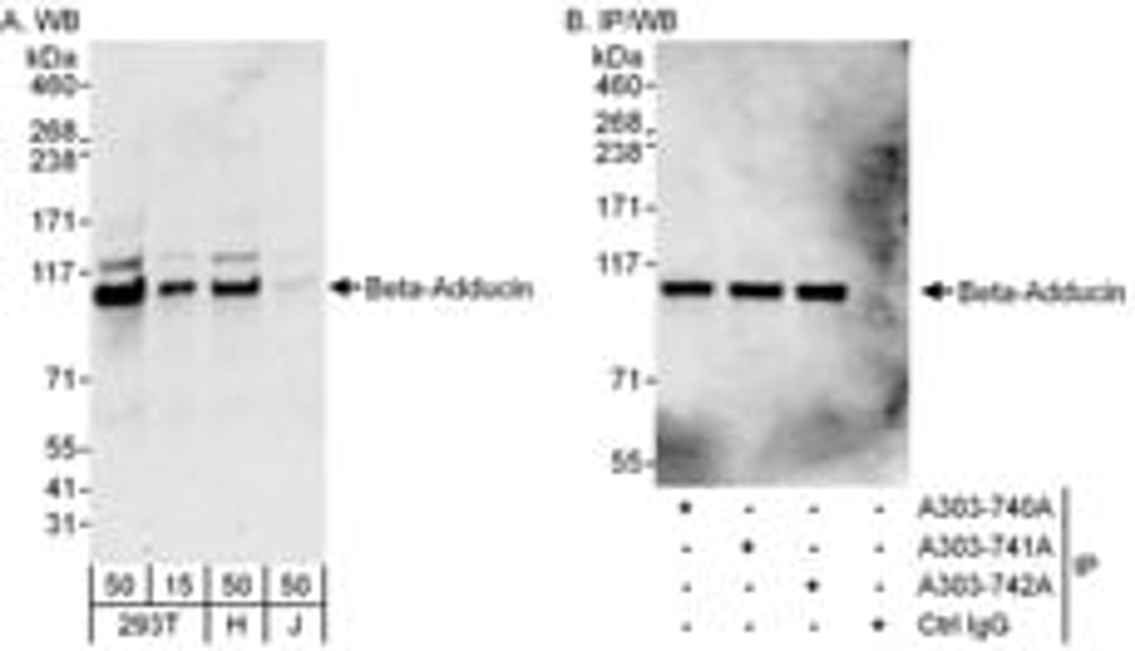 Detection of human Beta-Adducin by western blot and immunoprecipitation.