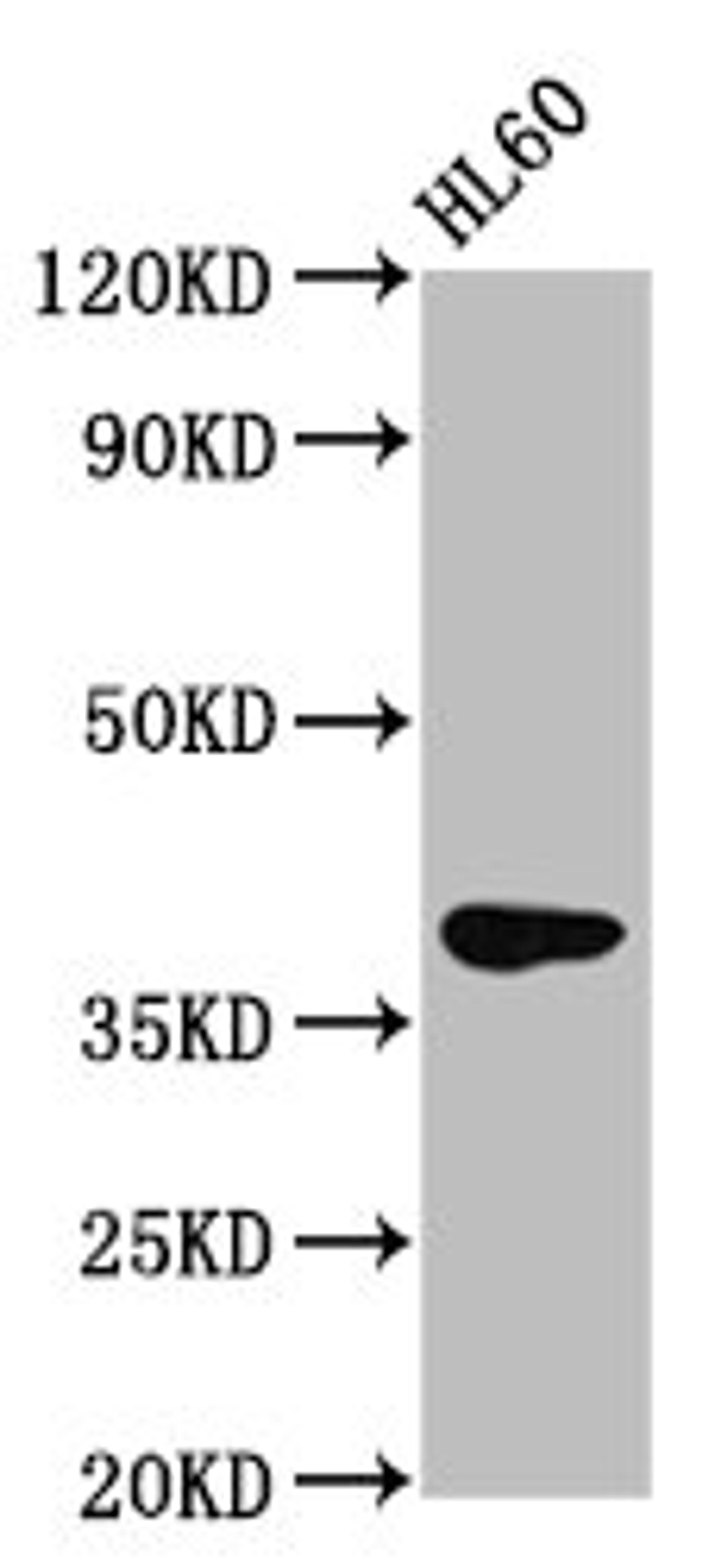 Western Blot. Positive WB detected in: HL60 whole cell lysate. All lanes: GPR174 antibody at 2.8µg/ml. Secondary. Goat polyclonal to rabbit IgG at 1/50000 dilution. Predicted band size: 39 kDa. Observed band size: 39 kDa