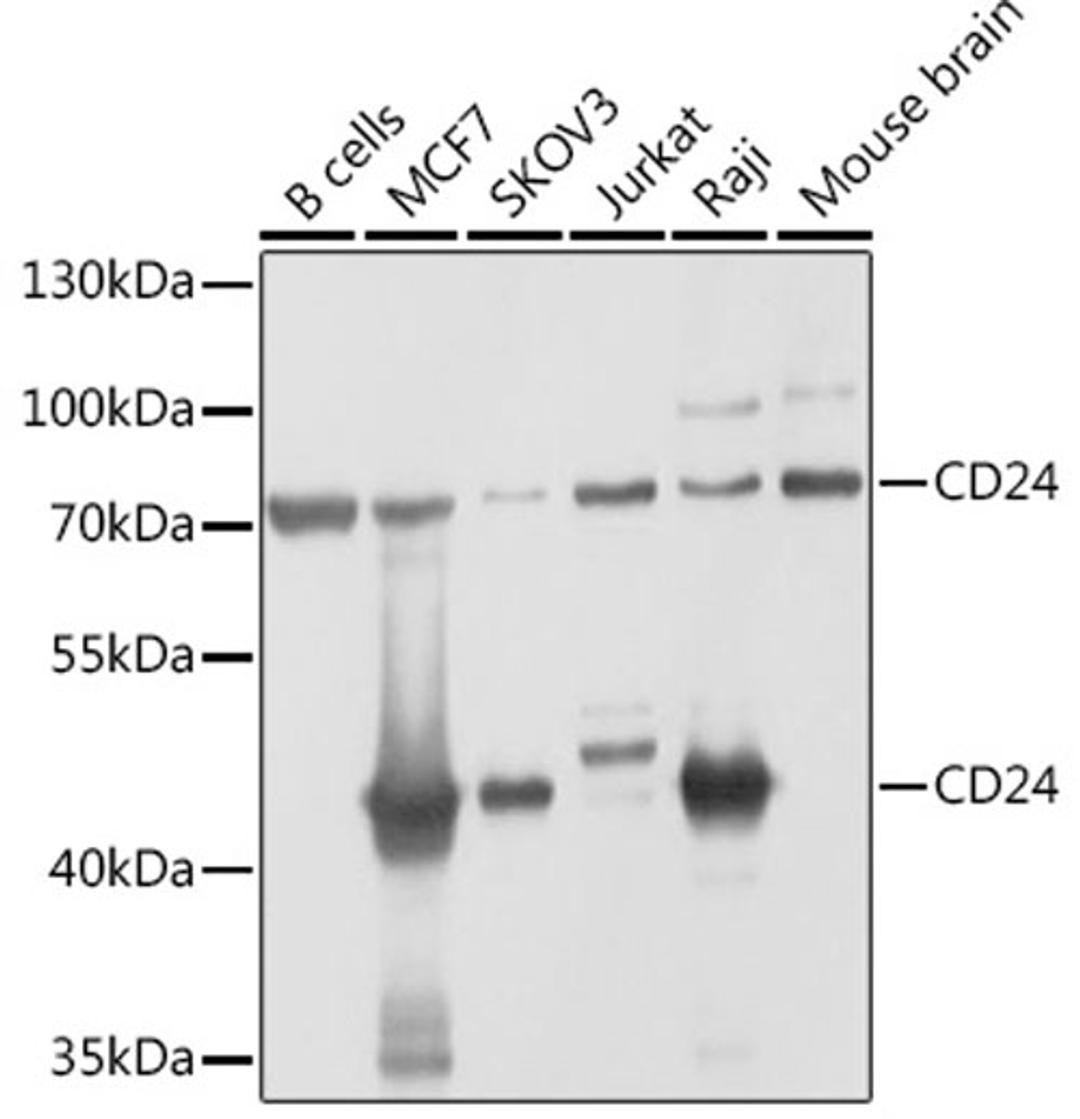 Western blot - CD24 antibody (A2207)