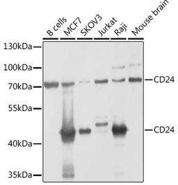 Western blot - CD24 antibody (A2207)