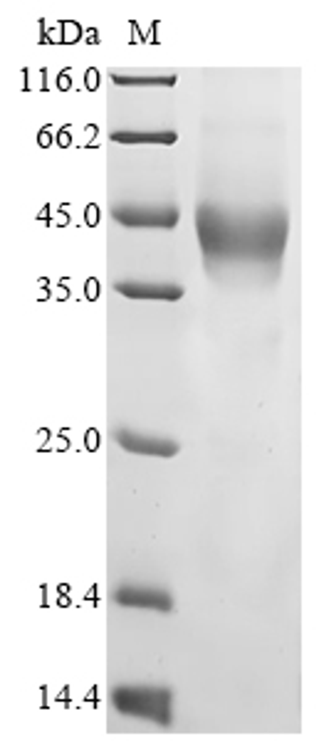 (Tris-Glycine gel) Discontinuous SDS-PAGE (reduced) with 5% enrichment gel and 15% separation gel.