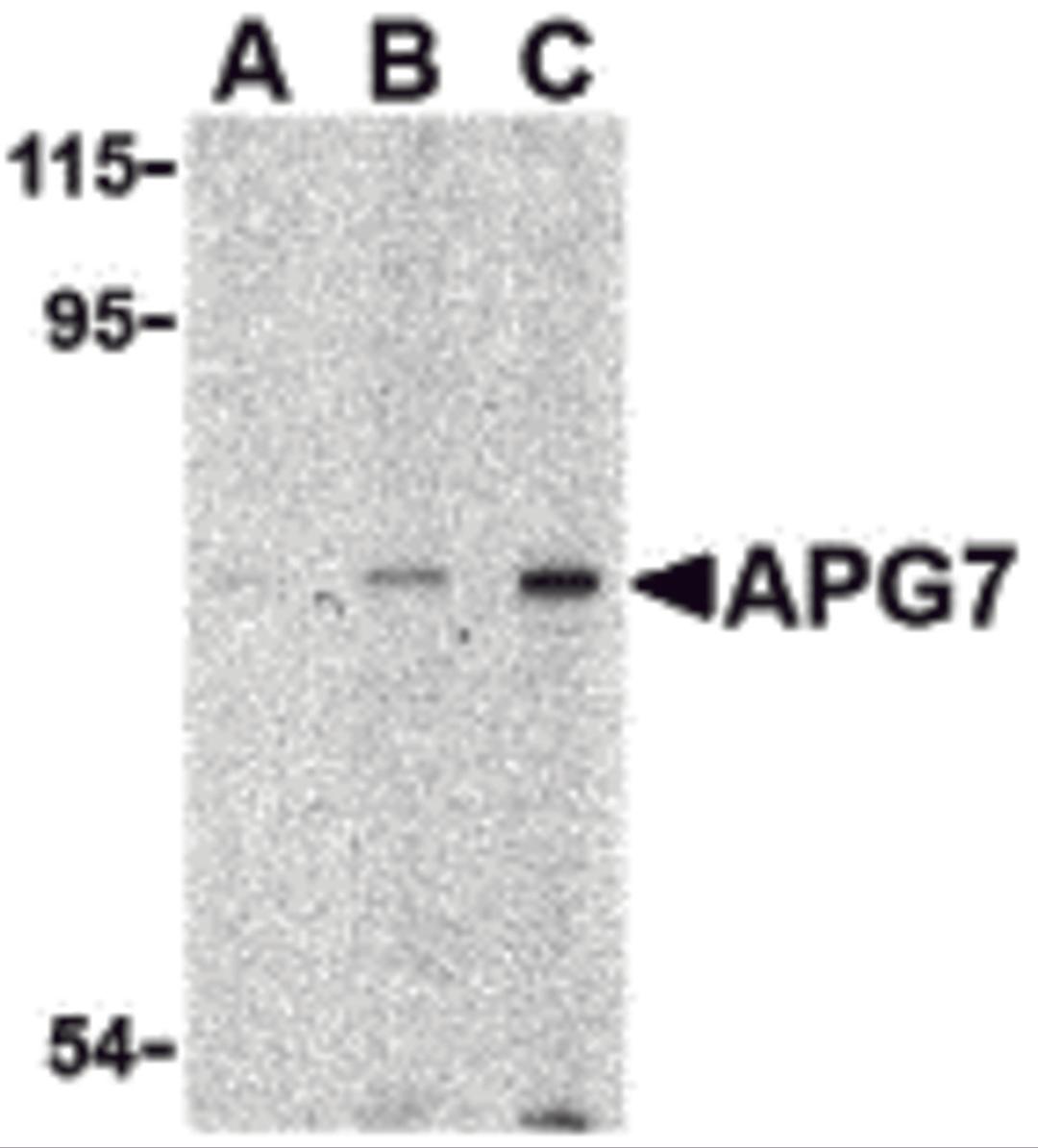 Western blot analysis of APG7 in L1210 cell lysate with APG7 antibody at (A) 1, (B) 2 and (C) 4 &#956;g/mL.