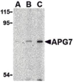 Western blot analysis of APG7 in L1210 cell lysate with APG7 antibody at (A) 1, (B) 2 and (C) 4 μg/mL.