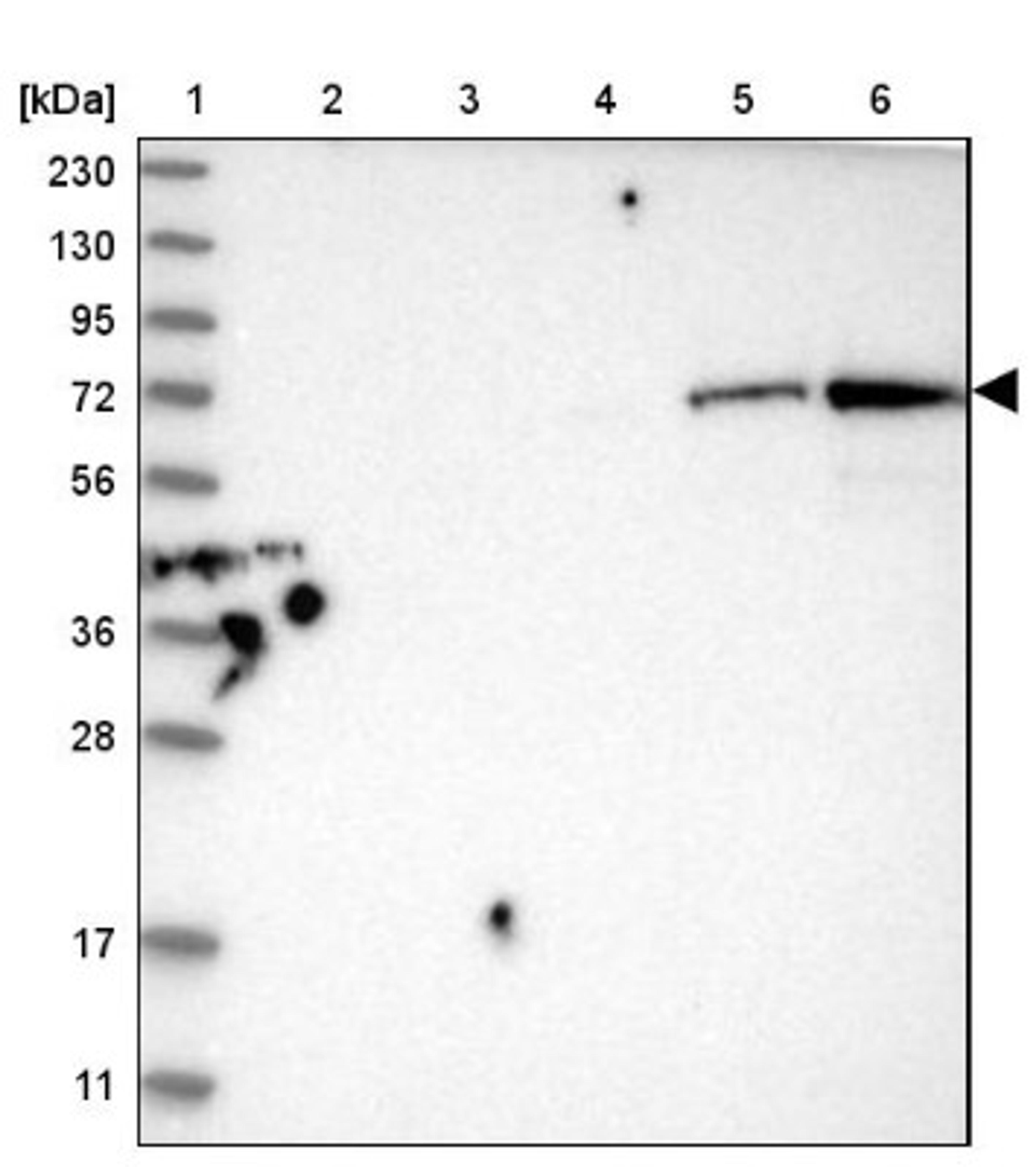 Western Blot: HEXDC Antibody [NBP1-83575] - Lane 1: Marker [kDa] 230, 130, 95, 72, 56, 36, 28, 17, 11<br/>Lane 2: Human cell line RT-4<br/>Lane 3: Human cell line U-251MG sp<br/>Lane 4: Human plasma (IgG/HSA depleted)<br/>Lane 5: Human liver tissue<br/>Lane 6: Human tonsil tissue