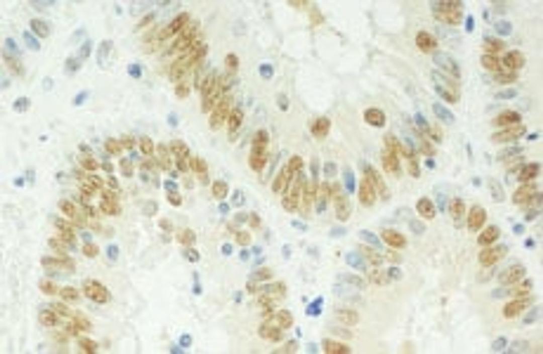 Detection of human SPF45 by immunohistochemistry.