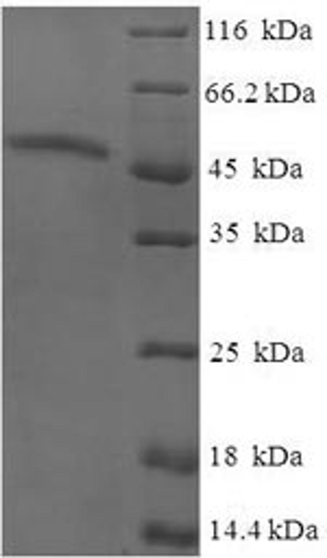 (Tris-Glycine gel) Discontinuous SDS-PAGE (reduced) with 5% enrichment gel and 15% separation gel.
