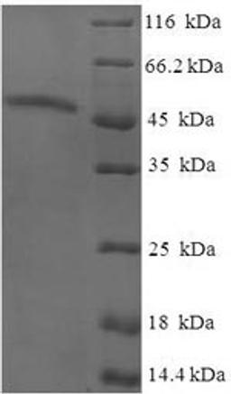 (Tris-Glycine gel) Discontinuous SDS-PAGE (reduced) with 5% enrichment gel and 15% separation gel.