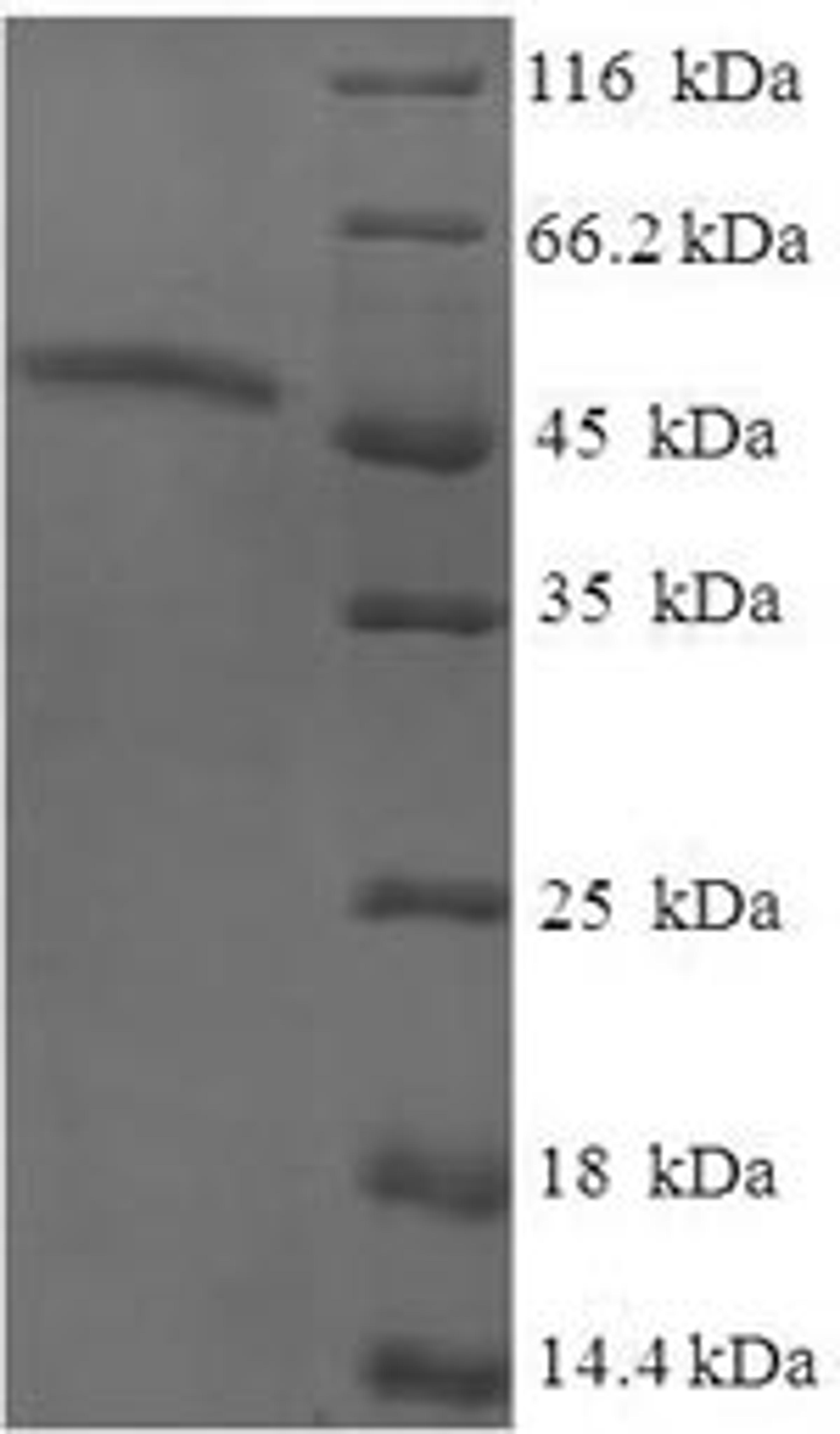 (Tris-Glycine gel) Discontinuous SDS-PAGE (reduced) with 5% enrichment gel and 15% separation gel.