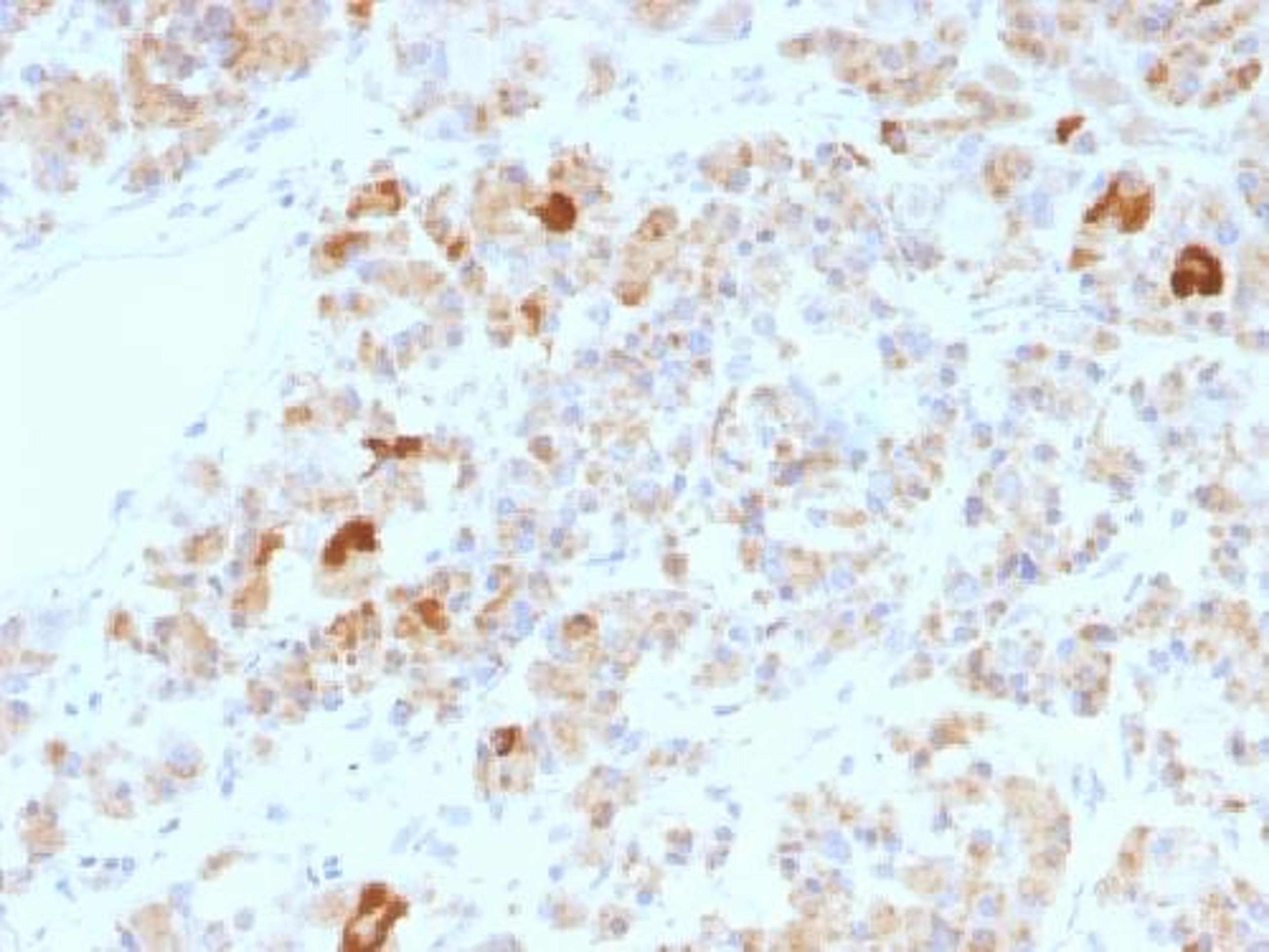 Immunohistochemical staining of human Pituitary tissue using LHA antibody