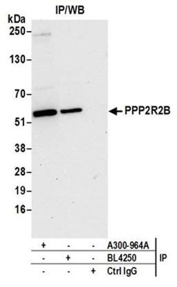 Detection of human PPP2R2B by western blot of immunoprecipitates.