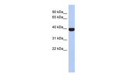 Antibody used in WB on Human Spleen at 0.2-1 ug/ml.