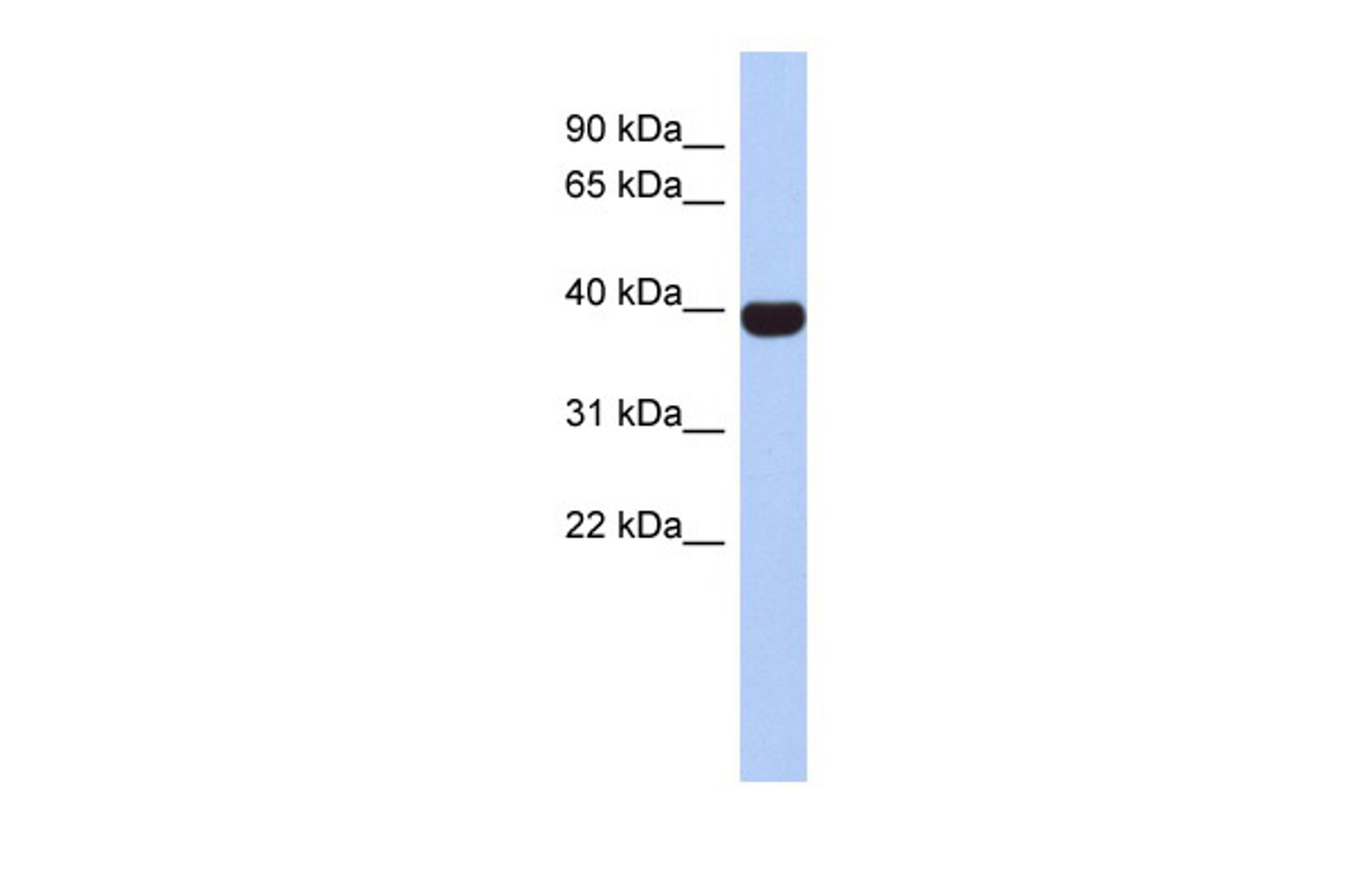 Antibody used in WB on Human Spleen at 0.2-1 ug/ml.